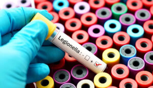 Hydrosense legionella test